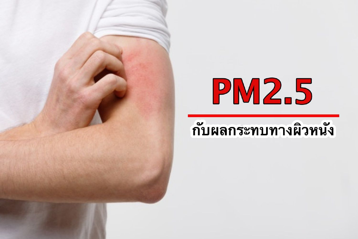 PM2.5 กับผลกระทบทางผิวหนัง และสัญญาณอันตรายของมะเร็งผิวหนัง PM2.5 กับผลกระทบทางผิวหนัง และสัญญาณอันตรายของมะเร็งผิวหนัง
