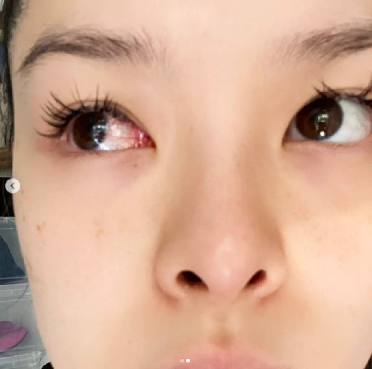 "ลิเดีย" เจอผลกระทบจากฝุ่น PM 2.5 ทำตาแดงก่ำ หลังแวะออกไปซื้อของแป๊บเดียว