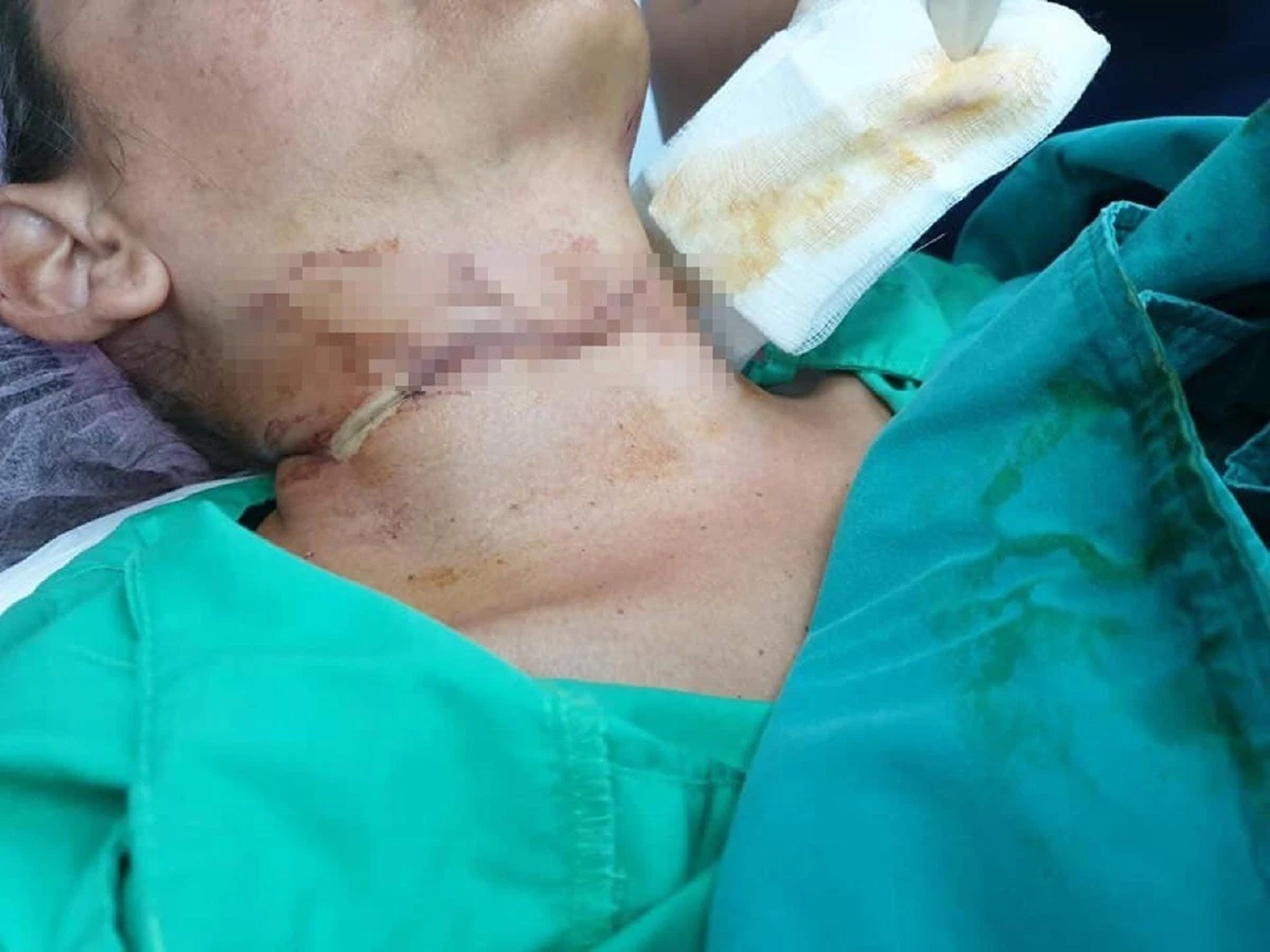 สยอง! 2 นักท่องเที่ยวสาวขี่จยย.ชมเมืองถูกสายสื่อสารบาดคอเหวอะหวะ