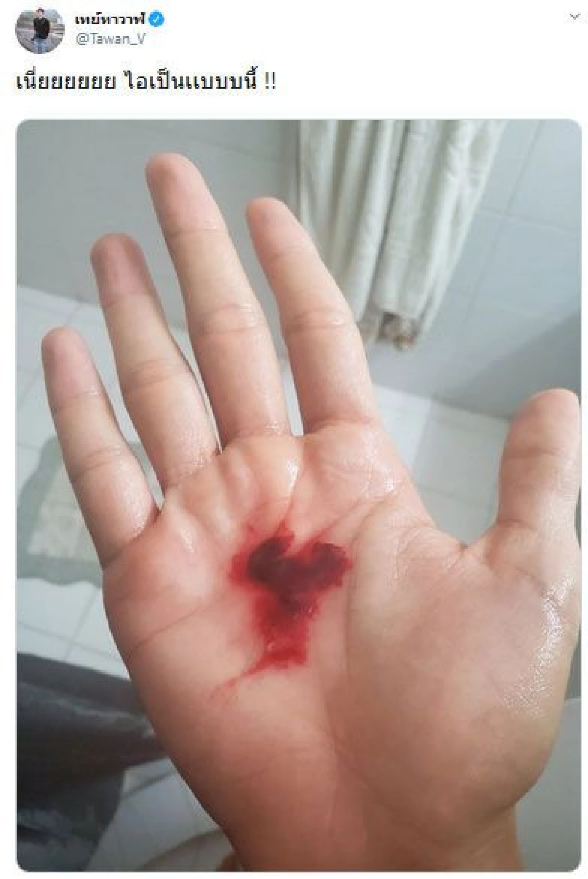 สุขภาพย่ำแย่! เต ตะวัน เผยภาพไอเป็นเลือด โดนฝุ่นพิษเล่นงานอีกคน