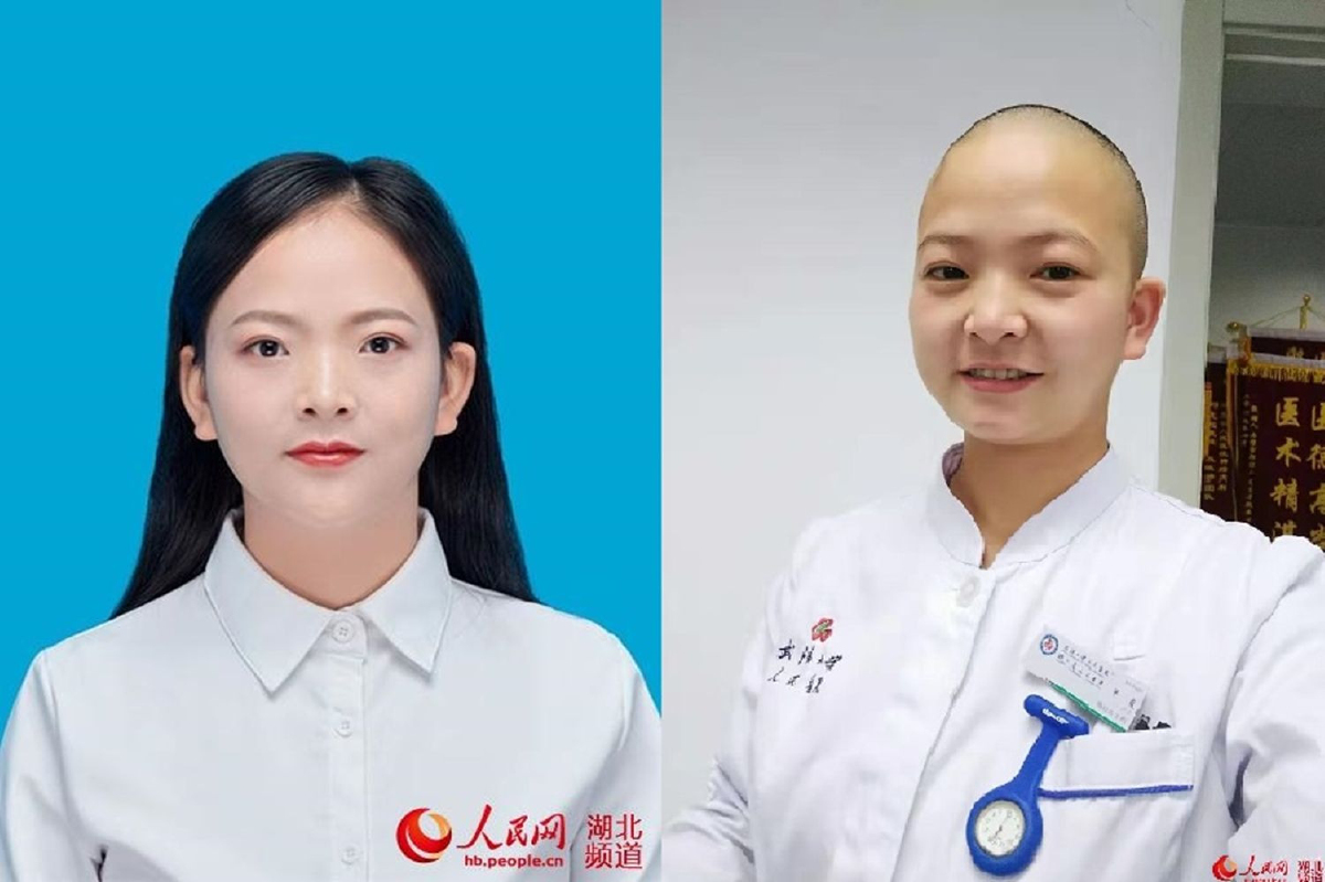 พยาบาลสาวจีนหั่นผมสกัดติดเชื้อ ช่วยกู้วิกฤตการระบาดไวรัสอู่ฮั่น พยาบาลสาวจีนหั่นผมสกัดติดเชื้อ ช่วยกู้วิกฤตการระบาดไวรัสอู่ฮั่น
