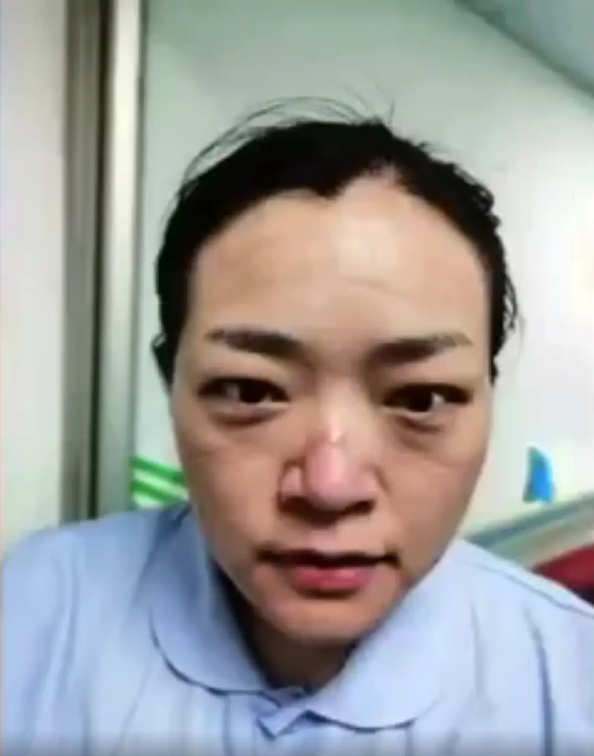 ใบหน้าที่บอบช้ำกับความทุ่มเทของทีมแพทย์ในแนวหน้า