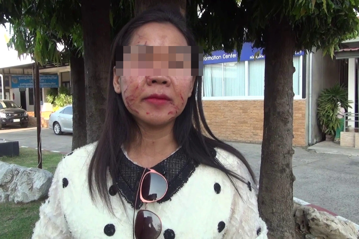 พ่อแม่สามีแจ้งความจับลูกชาย ทำร้ายสะใภ้เลือดสาด