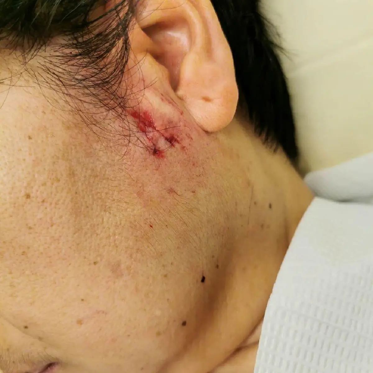 "มิน พีชญา" อัพเดทอาการพี่เลี้ยงและสุนัขที่บ้าน หลังถูกสุนัขปริศนากัด