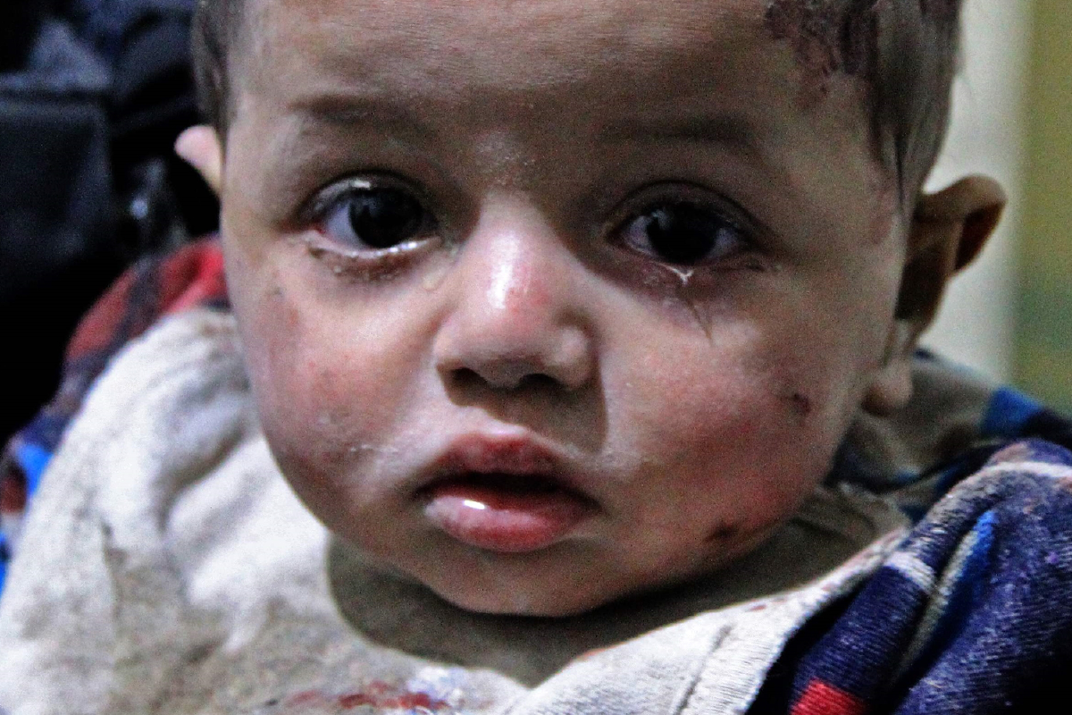 เด็กๆ เหยื่อความรุนแรงในซีเรีย การโจมตีที่อิดลิบพลเรือนดับ12