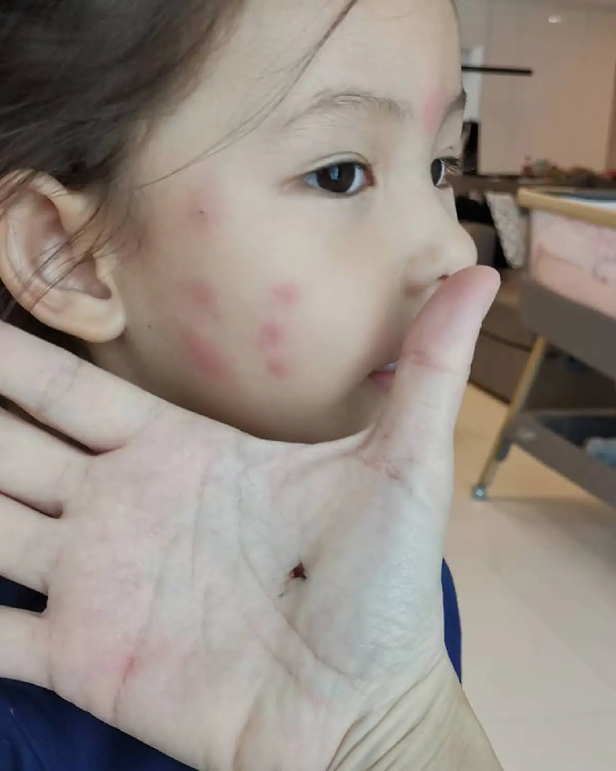 “แอน อลิชา” โมโหหนัก “น้องริชา” ตุ่มแดงขึ้นเต็มหน้า พลิกห้องนอนเพื่อจัดการ