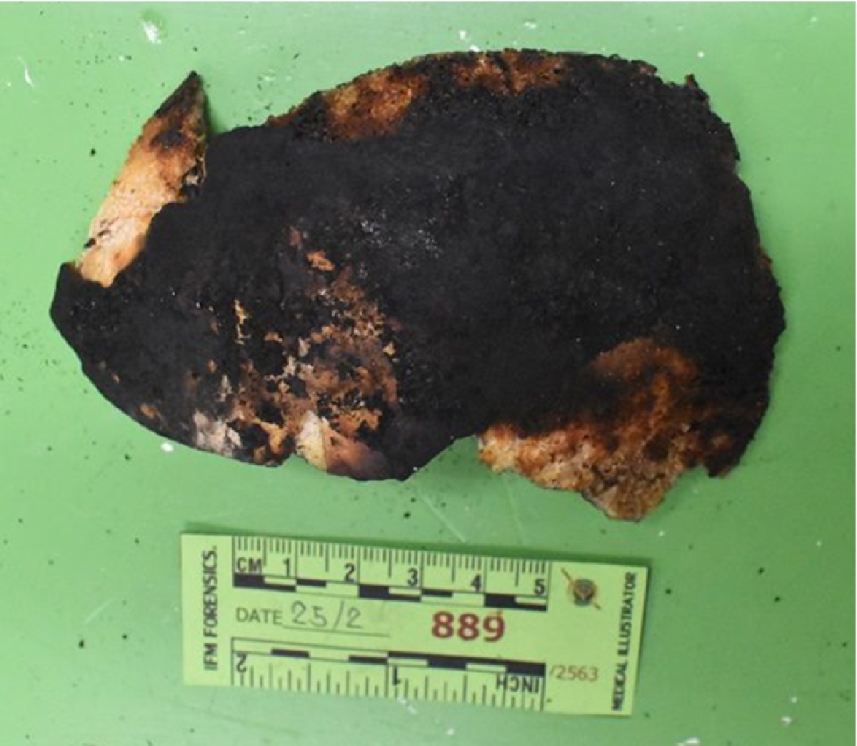 ชัดแล้ว! ผลดีเอ็นเอกระโหลกศีรษะถูกเผาเป็นของพี่ชายผู้พิพากษาที่ถูกอุ้ม