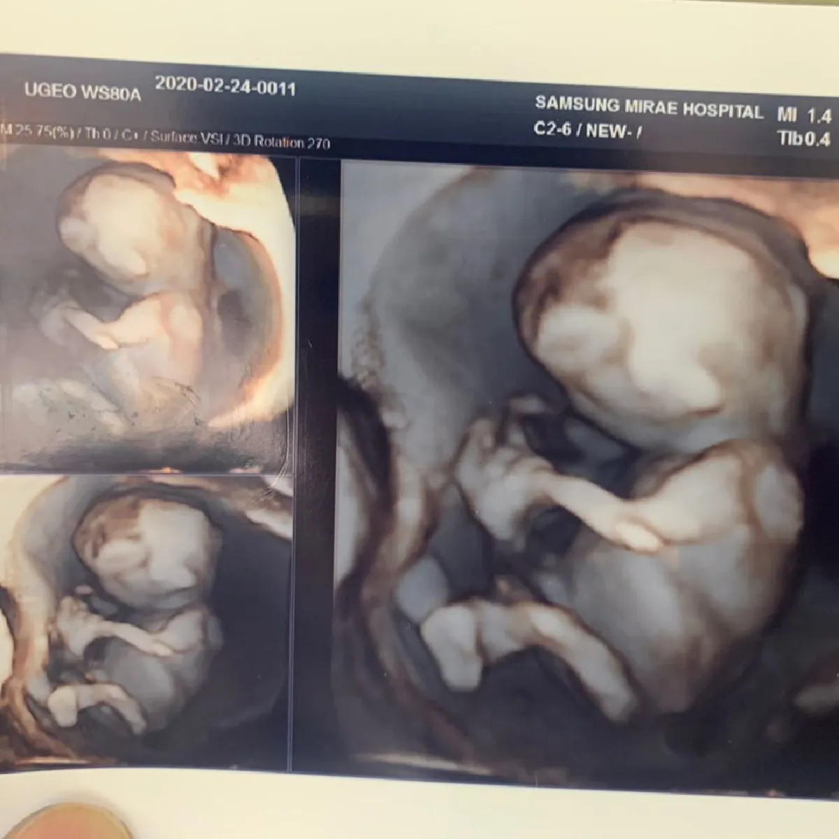 คิดถึงมาก! อ้วน รังสิต โพสต์กอดภรรยาผ่านไอจี หลังตั้งท้องอยู่เกาหลีกลับมาไทยไม่ได้ 