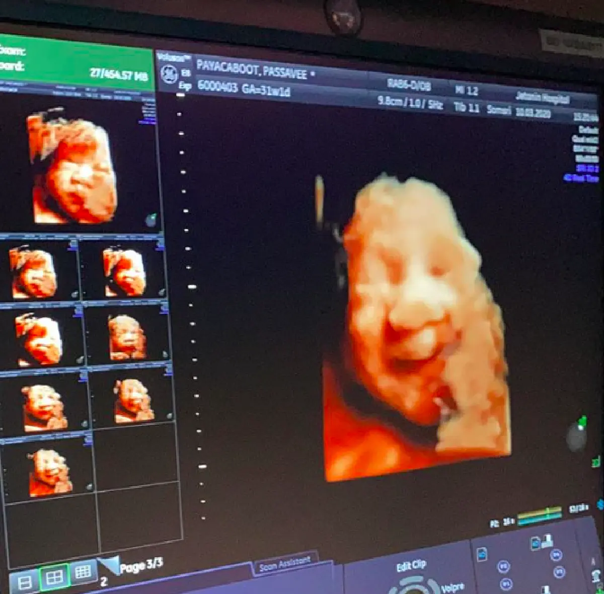 “นาวิน ต้าร์” เผยภาพอัลตร้าซาวนด์ลูกคนที่ 2 พร้อมบอกชื่อ