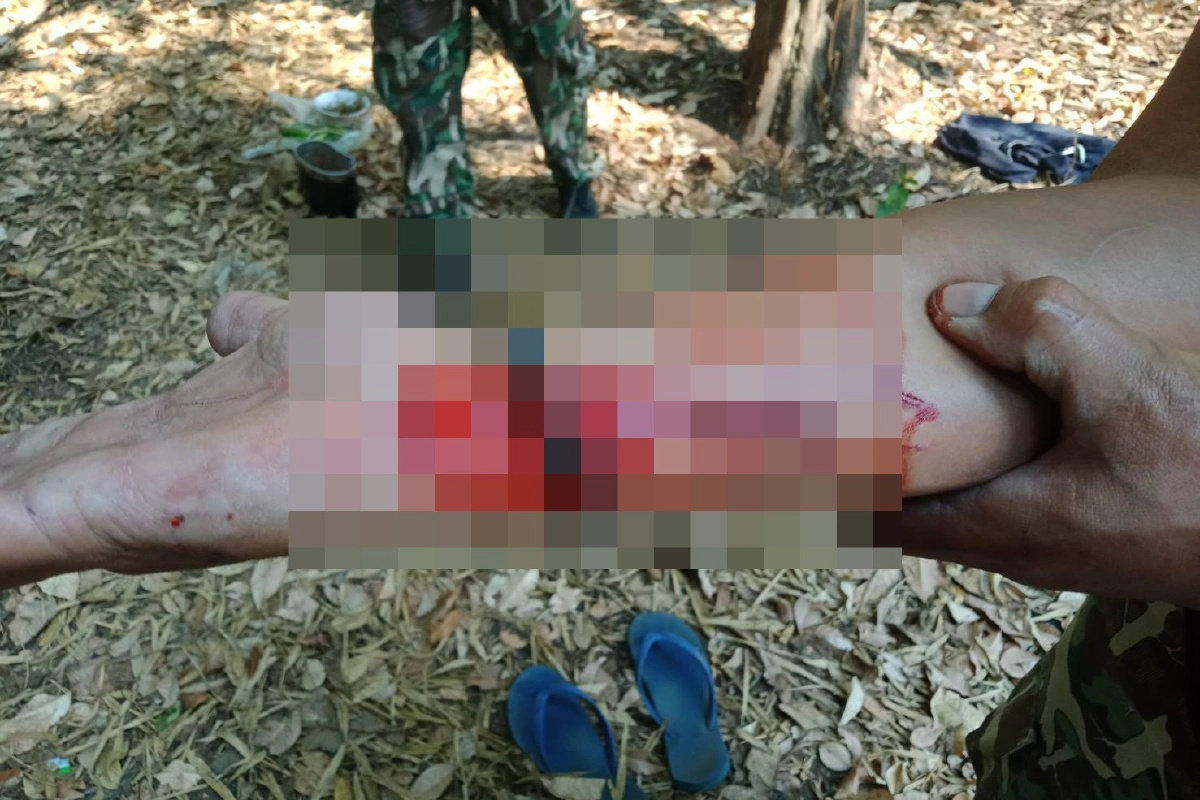 พรานล่าสัตว์ต้นเหตุเผาป่าเมืองกาญจน์ไล่ฟันเจ้าหน้าที่เจ็บ