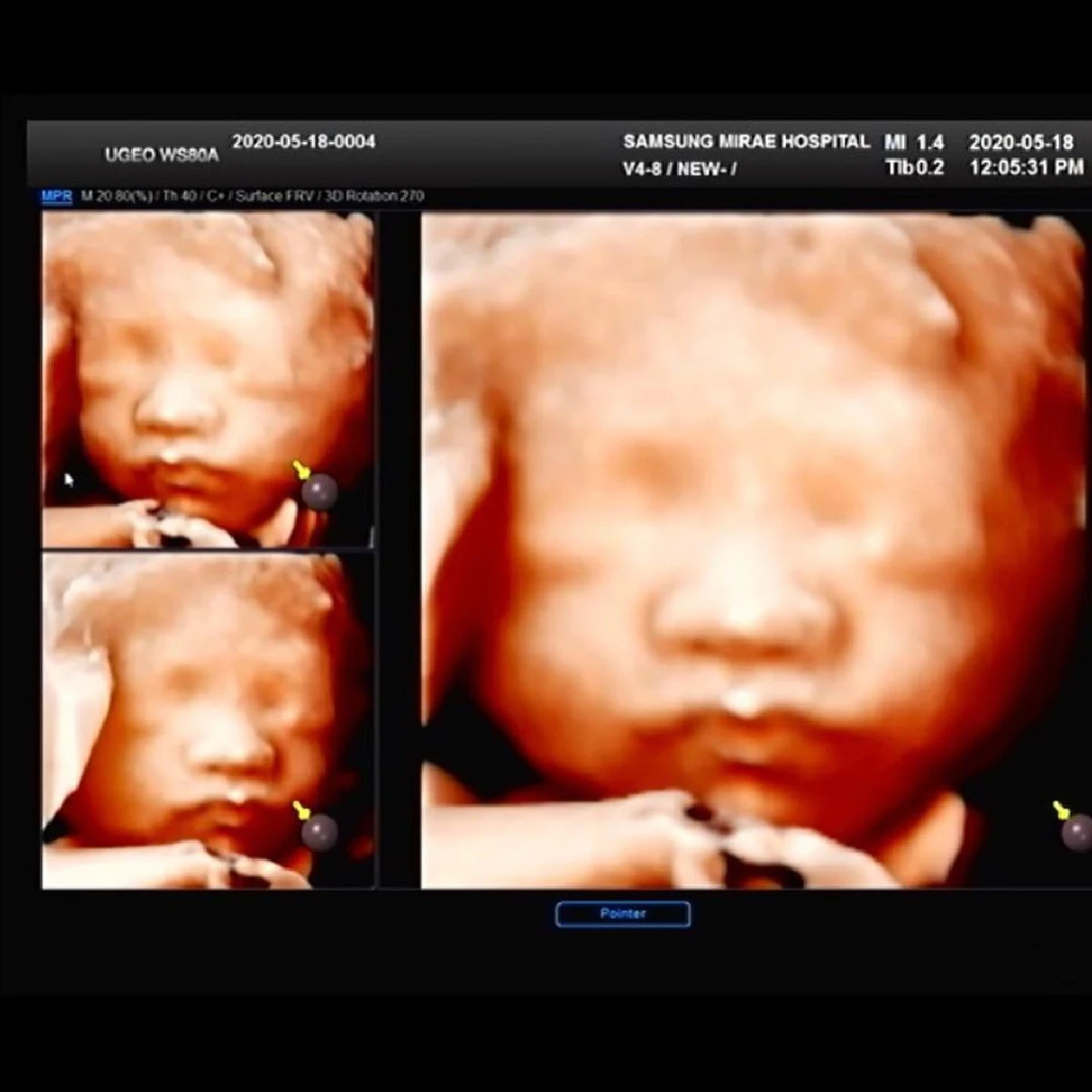 นึกว่าคลอดแล้ว! อ้วน รังสิต เผยภาพใบหน้าลูกชายคนแรกตั้งแต่ในท้อง