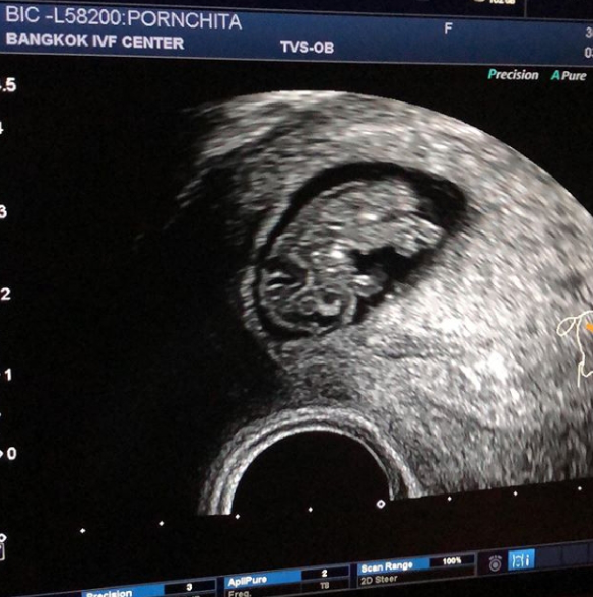 มิค บรมวุฒิ เฮลั่น เบนซ์ พรชิตา ตั้งท้องลูกคนที่ 3 แล้ว ได้ลูกชายสมใจอยาก