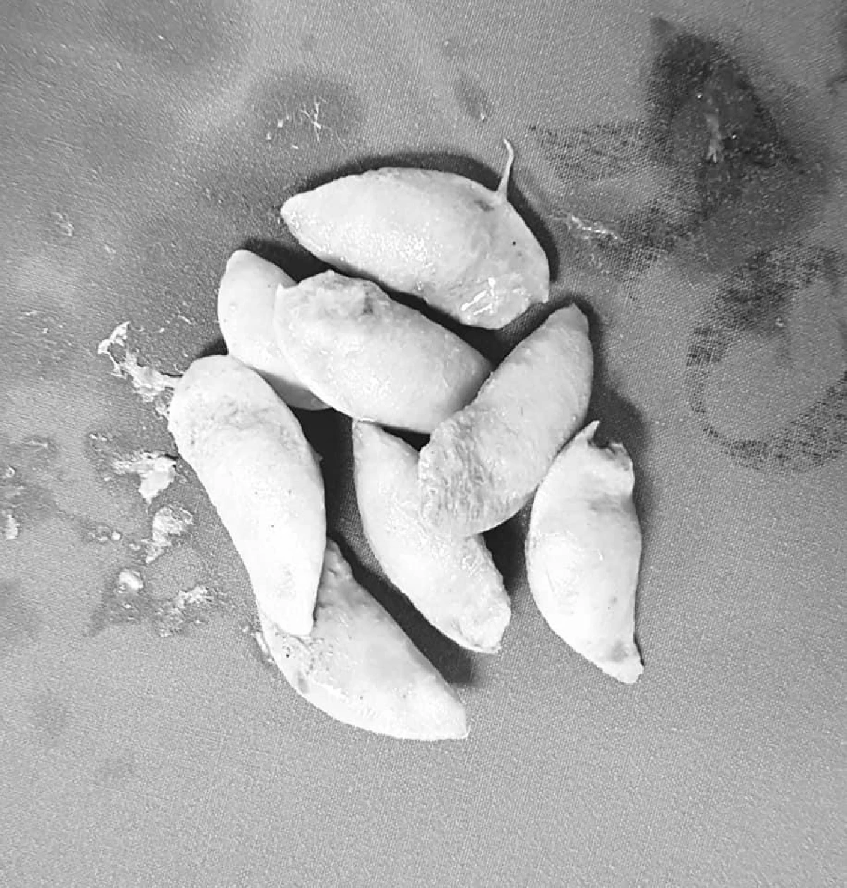 หมอเตือนลูกหลานสงสาร"ผู้สูงอายุ"อย่าให้กินกระท้อน