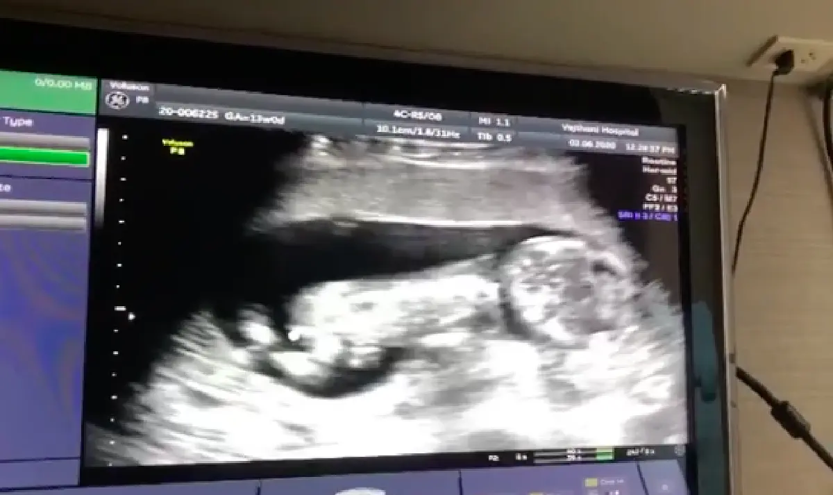 "ต๊ะ บอยสเก๊าท์" เผยภาพอัลตร้าซาวด์ลูกคนแรก บอกชัดลูกพ่อชัวร์!