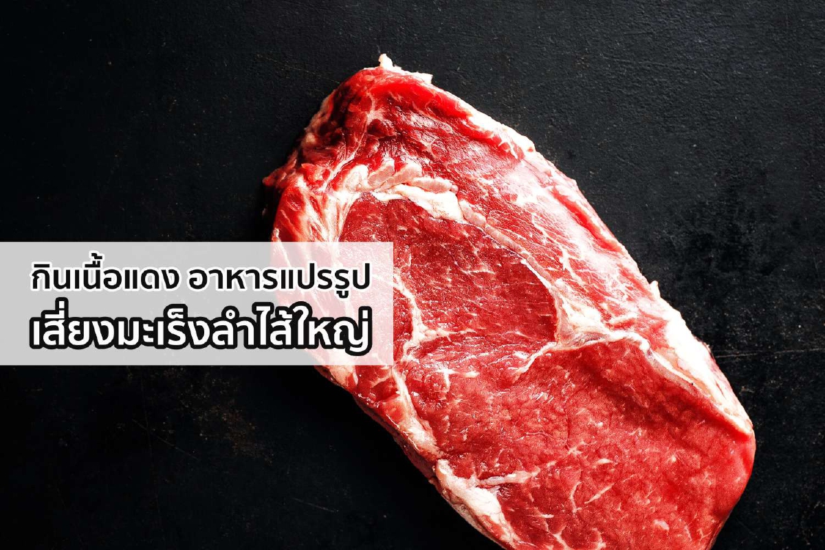 กินเนื้อแดง อาหารแปรรูป เสี่ยงมะเร็งลำไส้ใหญ่ กินเนื้อแดง อาหารแปรรูป เสี่ยงมะเร็งลำไส้ใหญ่