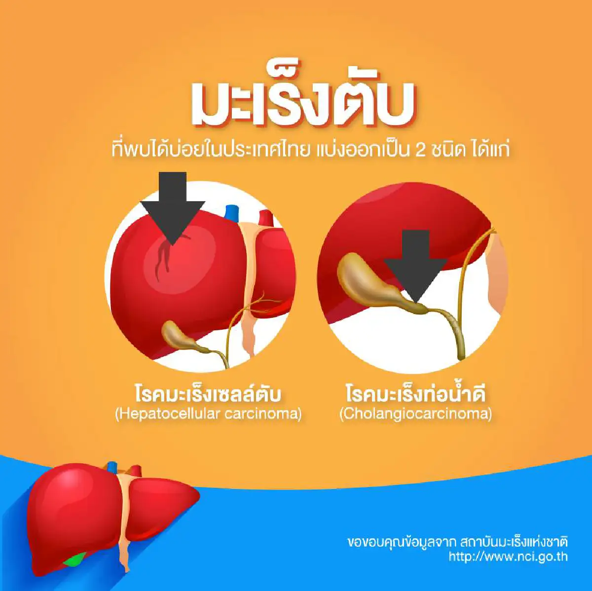 โรคมะเร็งตับ ความเสี่ยงและการป้องกัน