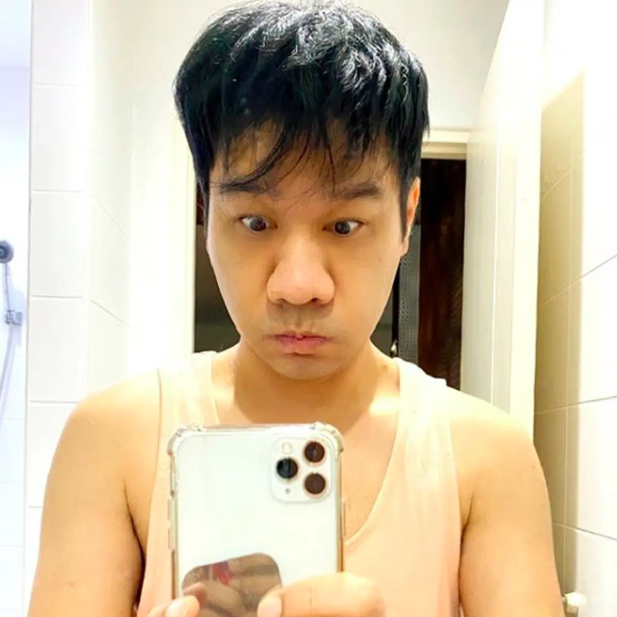  “กอล์ฟ เบญจพล” เผยใบหน้าหลังเข้าผ่าตัดทำศัลยกรรมครั้งแรก 