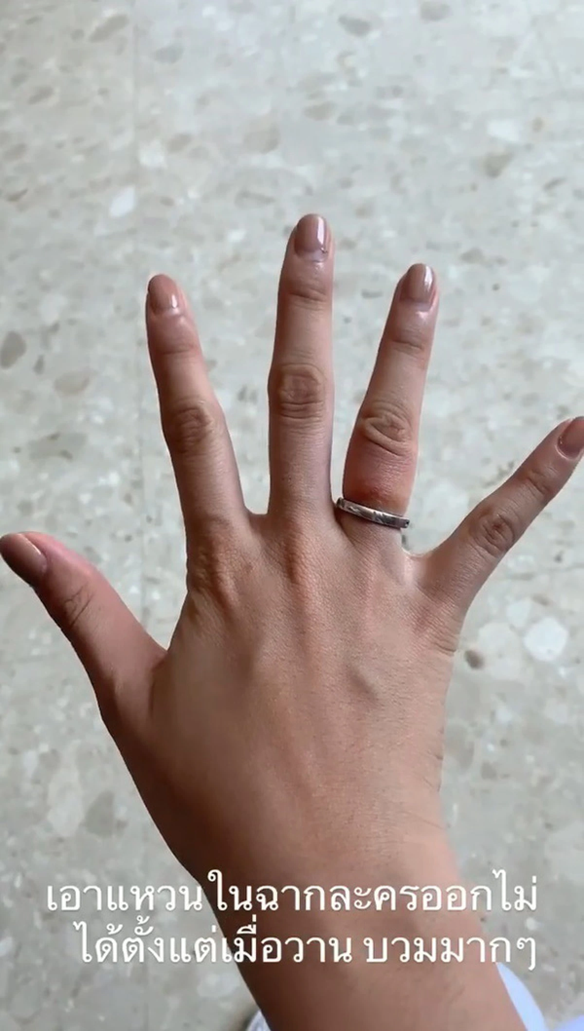 “ปุ๊กลุก” ถอดแหวนที่ใส่เข้าฉากไม่ได้ค้างข้ามวัน จนกู้ภัยต้องมาช่วยตัด!