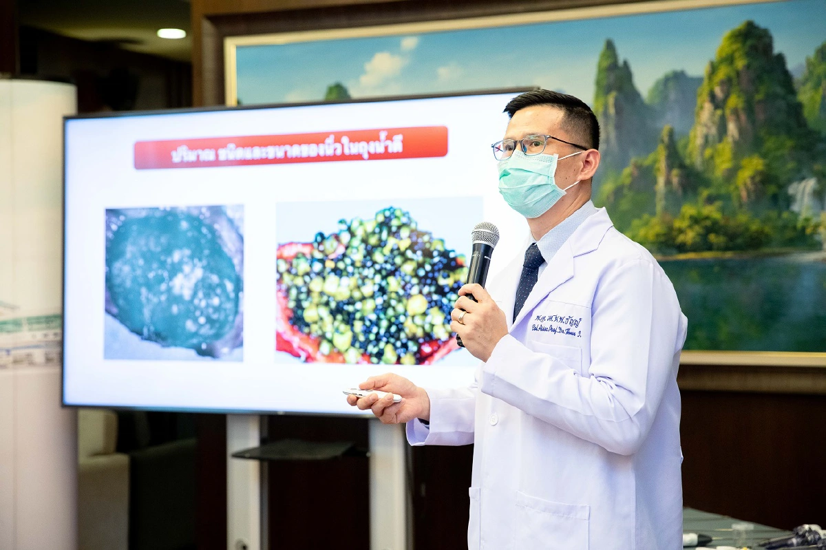 แนวทางการรักษานิ่วในถุงน้ำดี และนิ่วในท่อน้ำดีในครั้งเดียว โดยเทคโนโลยีการส่องกล้อง (ERCP) และผ่าตัดผ่านกล้องแผลเล็ก (LC) 