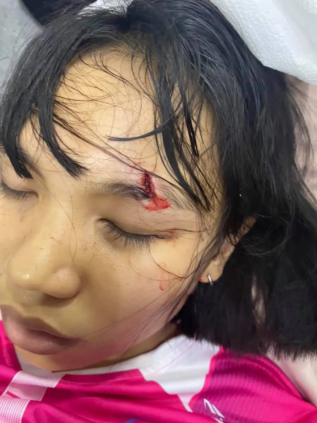 "ลิลลี่ ได้หมดถ้าสดชื่น" จู่ๆ วูบล้มหัวฟาดพื้น ขณะกำลังตัดผม