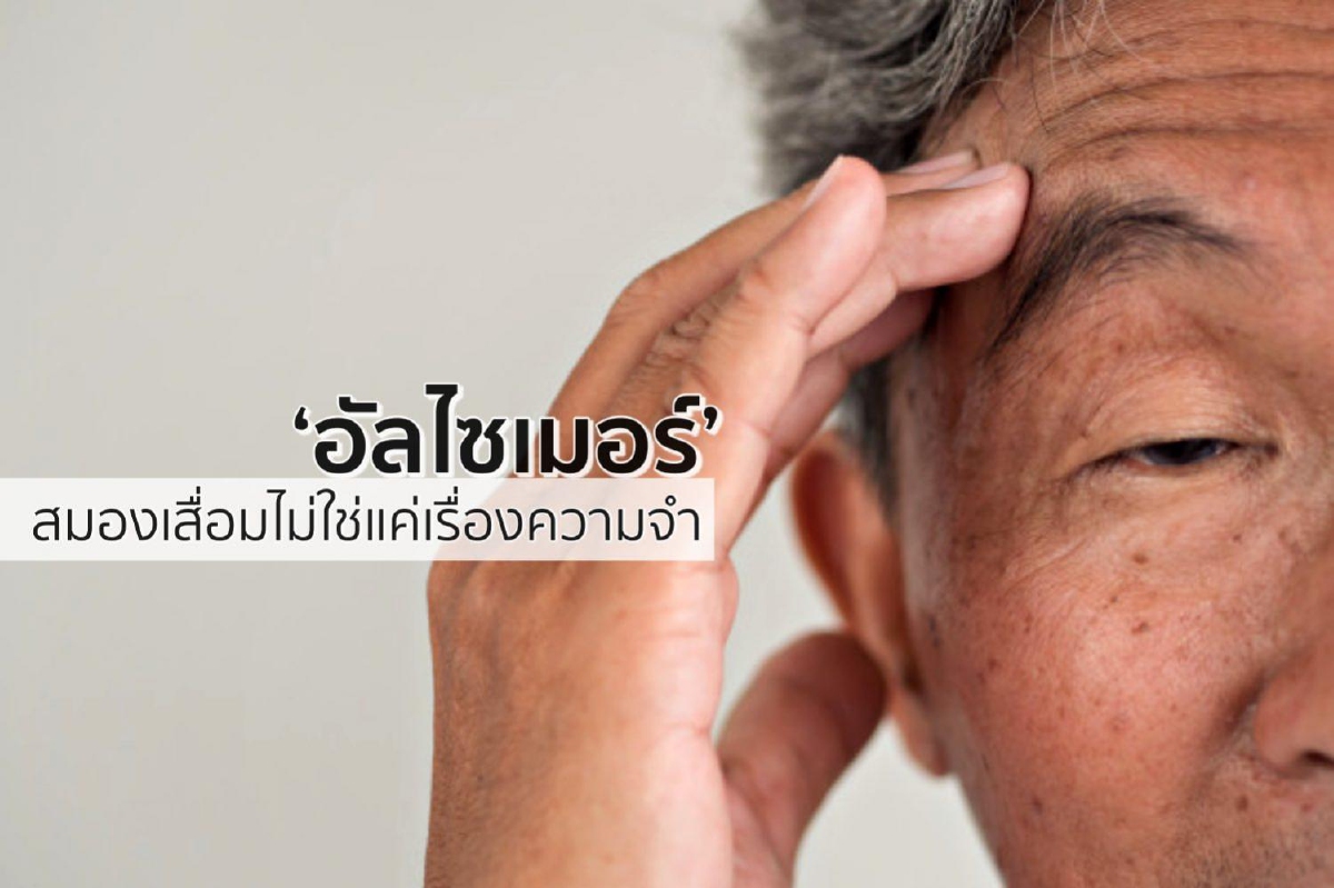 ‘อัลไซเมอร์’ สมองเสื่อมไม่ใช่แค่เรื่องความจำ ‘อัลไซเมอร์’ สมองเสื่อมไม่ใช่แค่เรื่องความจำ