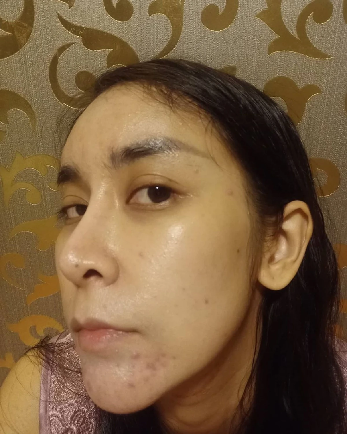 เสียสละเพื่อลูก! ใหม่ สุคนธวา แพ้ท้องสิวเห่อ ลั่นงานหายรายได้หดวันละแสน 