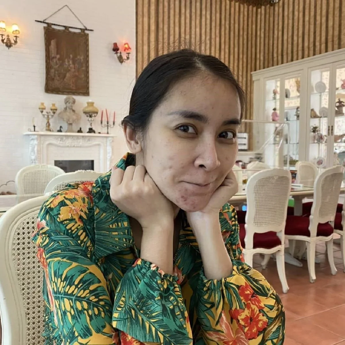 เสียสละเพื่อลูก! ใหม่ สุคนธวา แพ้ท้องสิวเห่อ ลั่นงานหายรายได้หดวันละแสน 