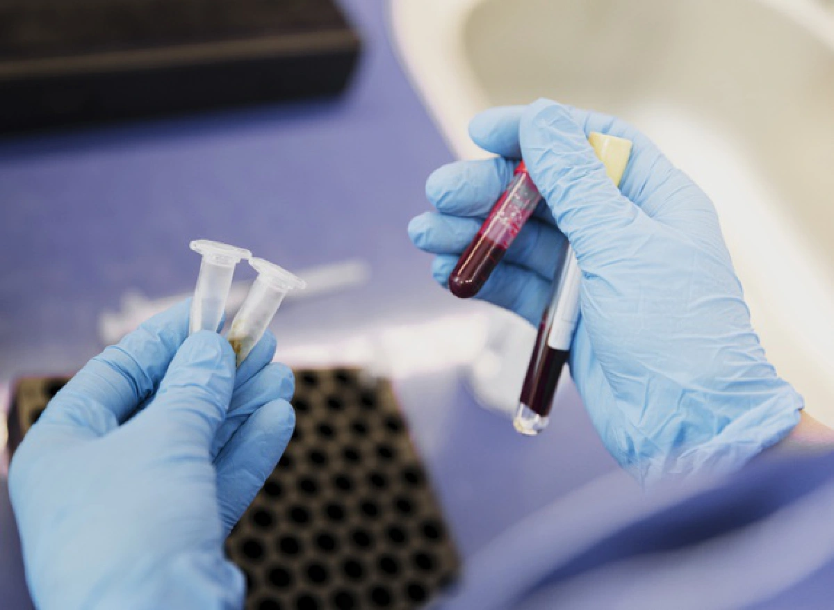 โลหิตจาง โรคที่อาการไม่น่าวางใจ