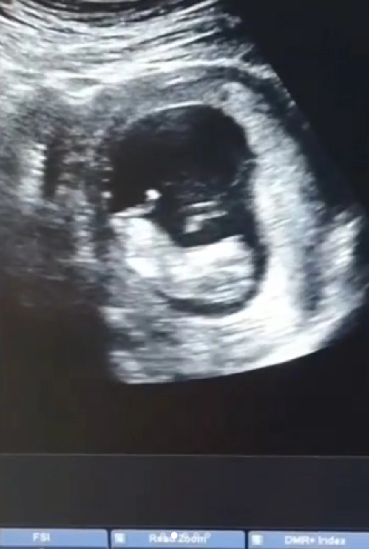 ท้องแล้วจ้า! “นาตาลี เดวิส” เผยภาพภาพอัลตราซาวด์ กำลังตั้งท้องลูกชาย