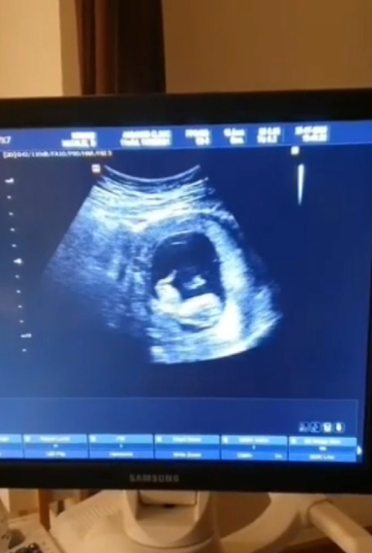 ท้องแล้วจ้า! “นาตาลี เดวิส” เผยภาพภาพอัลตราซาวด์ กำลังตั้งท้องลูกชาย