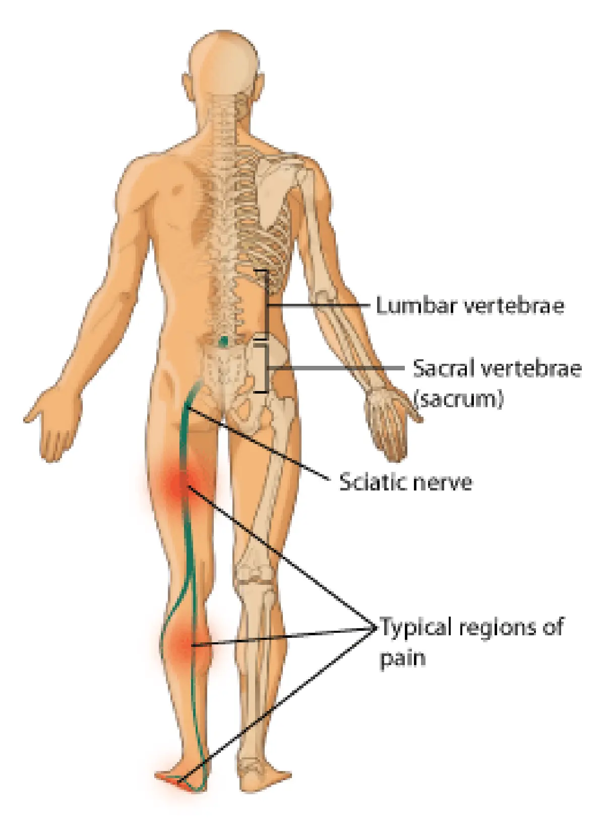 ที่เป็นอยู่นั้นแค่ปวดหลังธรรมดา..หรือว่าหลังเสื่อม
