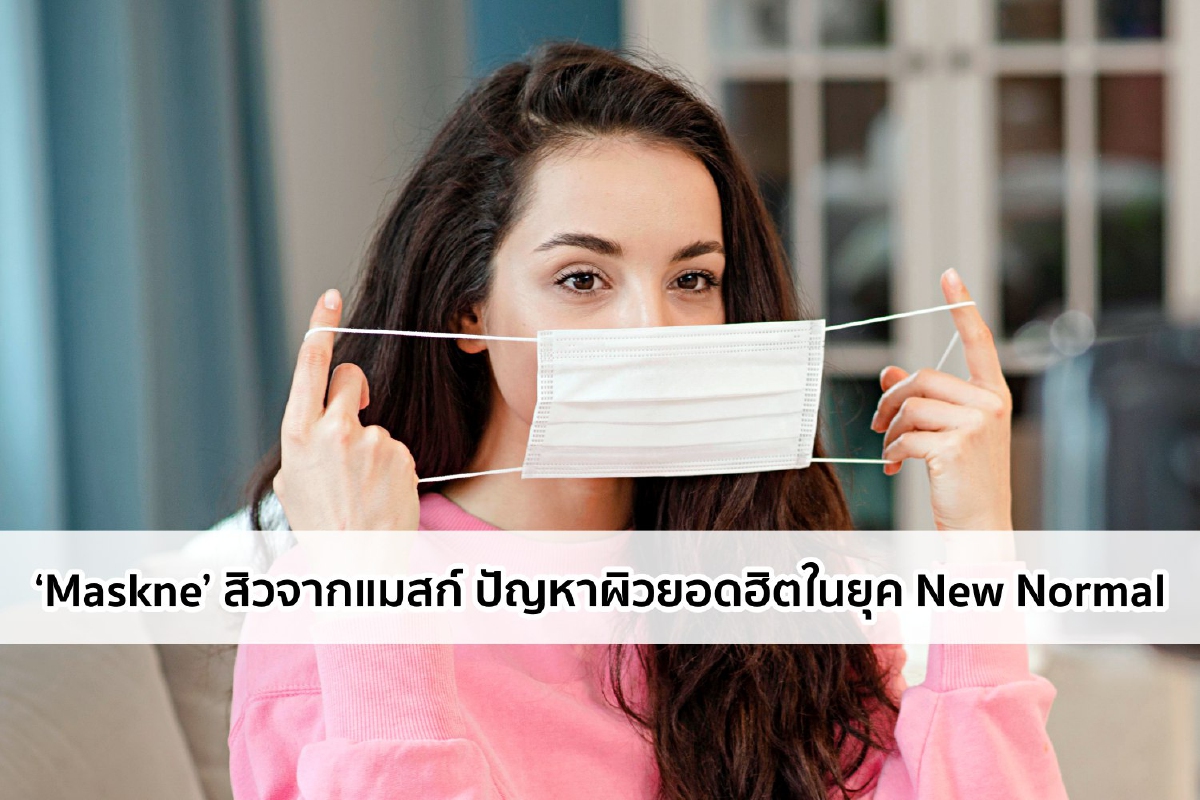 ‘Maskne’ สิวจากแมสก์ ปัญหาผิวยอดฮิตในยุค New Normal ‘Maskne’ สิวจากแมสก์ ปัญหาผิวยอดฮิตในยุค New Normal
