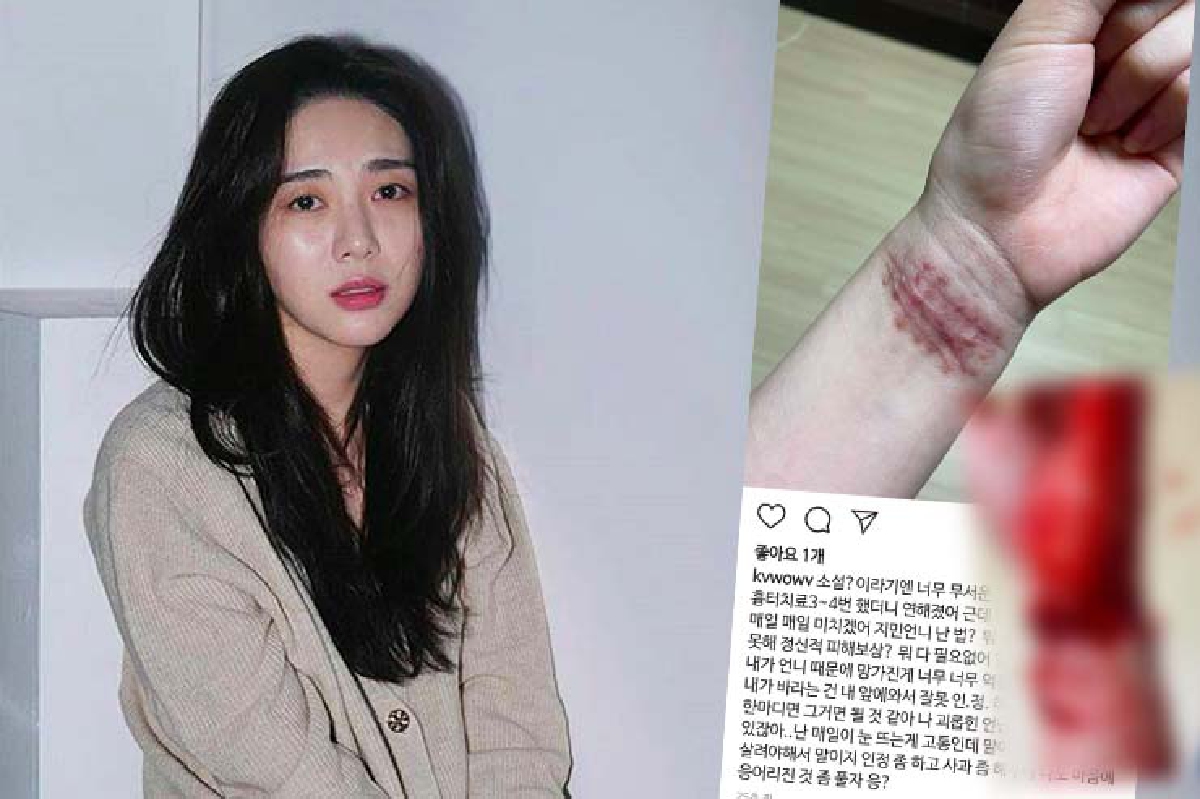 “มินอา” อดีตสมาชิก AOA โชว์รอยกรีดข้อมือ ฝากถึงเพื่อนร่วมวง-ประธานค่ายไม่ต้องมางานศพ “มินอา” อดีตสมาชิก AOA โชว์รอยกรีดข้อมือ ฝากถึงเพื่อนร่วมวง-ประธานค่ายไม่ต้องมางานศพ