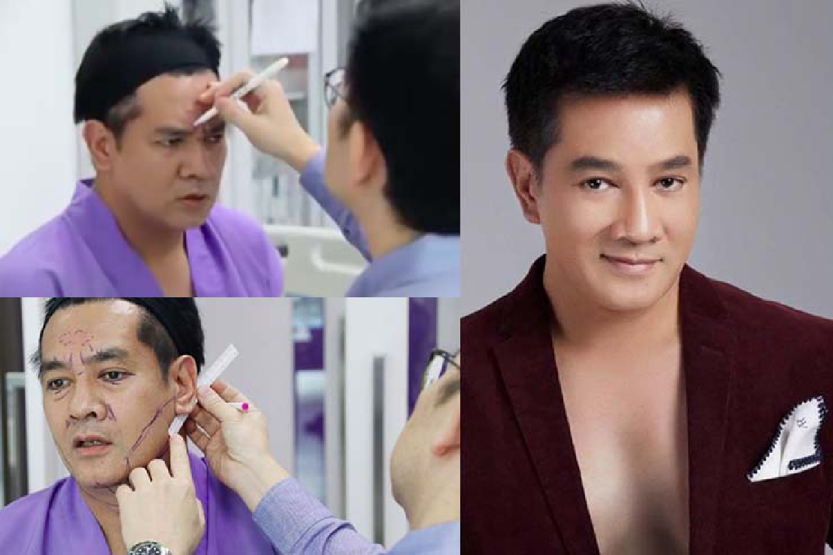 "ต้น จักรกฤษณ์” เปิดใจครั้งแรก หลังตัดสินใจทำศัลยกรรมครั้งใหญ่นานถึง 8 ชั่วโมง "ต้น จักรกฤษณ์” เปิดใจครั้งแรก หลังตัดสินใจทำศัลยกรรมครั้งใหญ่นานถึง 8 ชั่วโมง
