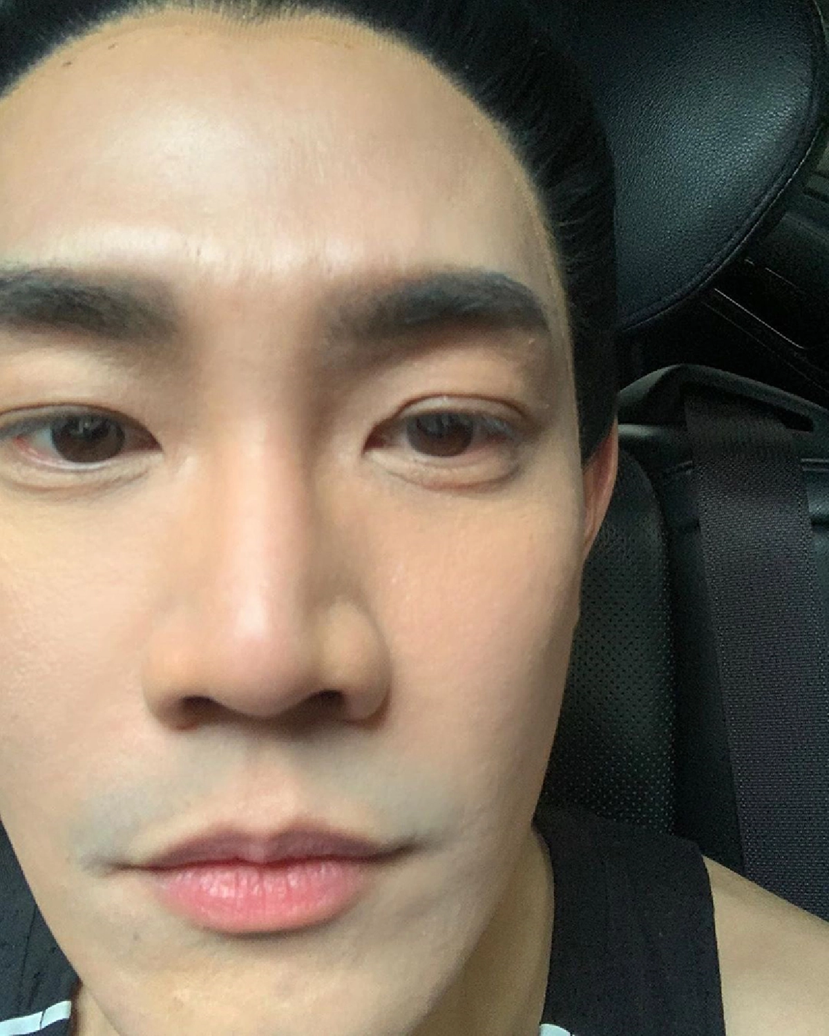 ตาเกือบบอด! ฟลุค จิระ แชร์อุทาหรณ์คอนแทคเลนส์ขาด ติดคาลูกตา 10 ชม.