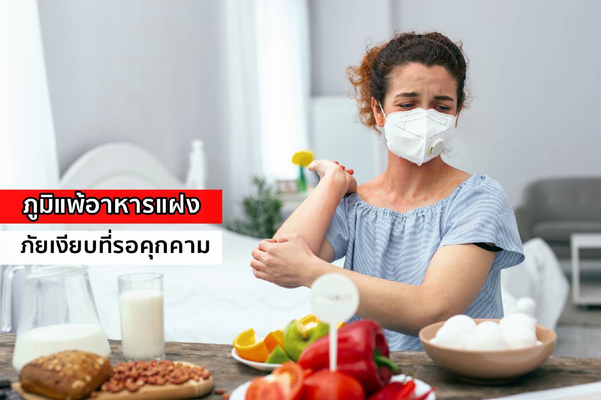 ภูมิแพ้อาหารแฝง...ภัยเงียบที่รอคุกคาม ภูมิแพ้อาหารแฝง...ภัยเงียบที่รอคุกคาม