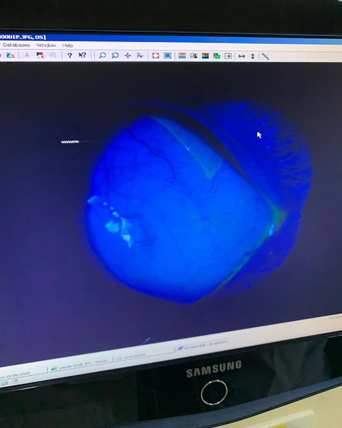 ตาเกือบบอด! ฟลุค จิระ แชร์อุทาหรณ์คอนแทคเลนส์ขาด ติดคาลูกตา 10 ชม.