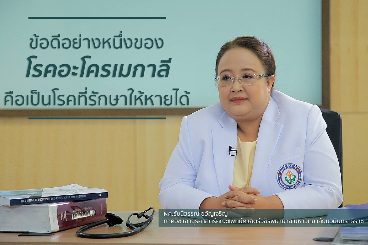 'อะโครเมกาลี' อาการของโรคที่มีฮอร์โมนเกินไปสังเกตอย่างไรได้บ้าง? 'อะโครเมกาลี' อาการของโรคที่มีฮอร์โมนเกินไปสังเกตอย่างไรได้บ้าง?