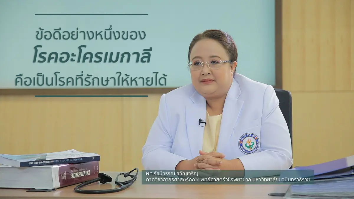 'อะโครเมกาลี' อาการของโรคที่มีฮอร์โมนเกินไปสังเกตอย่างไรได้บ้าง?