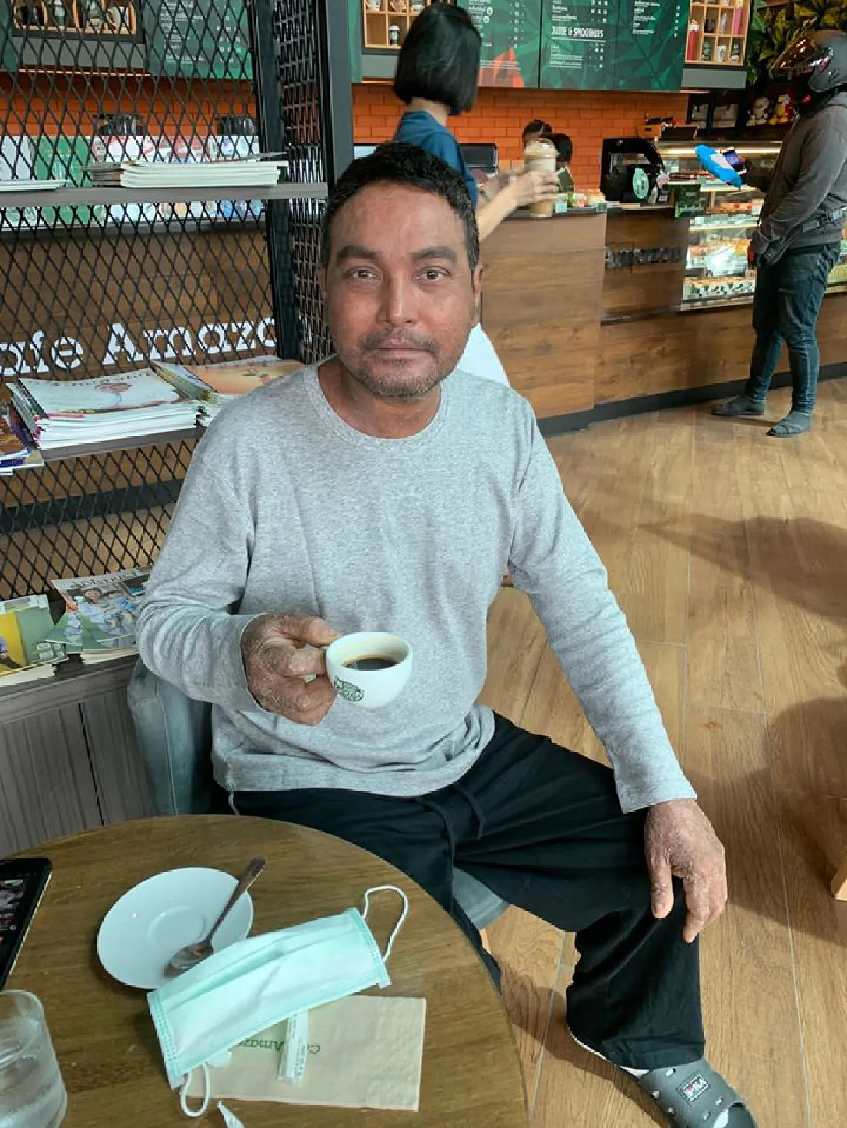 วินัย ไกรบุตร เผยภาพพันผ้าก็อซบริเวณใบหน้า บำบัดอาการป่วยต่อเนื่อง