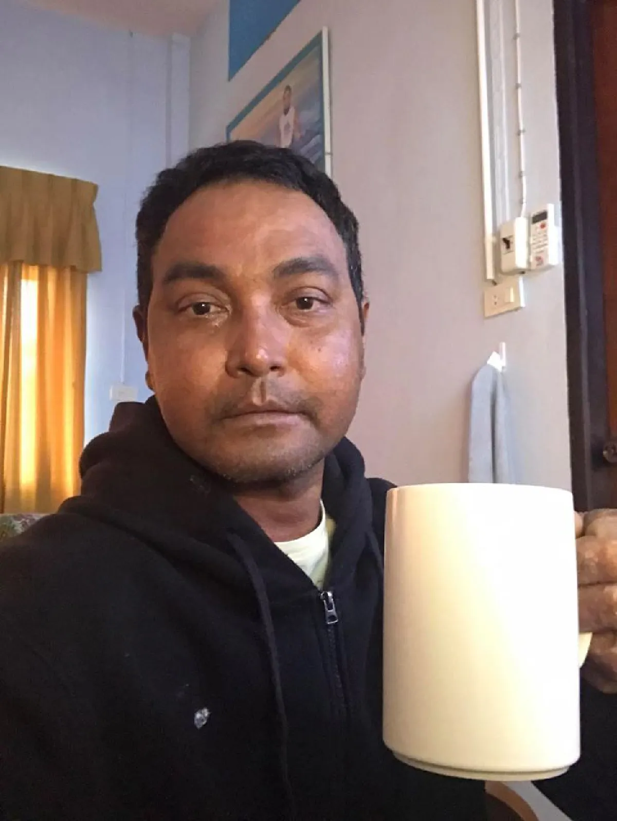 วินัย ไกรบุตร เผยภาพพันผ้าก็อซบริเวณใบหน้า บำบัดอาการป่วยต่อเนื่อง