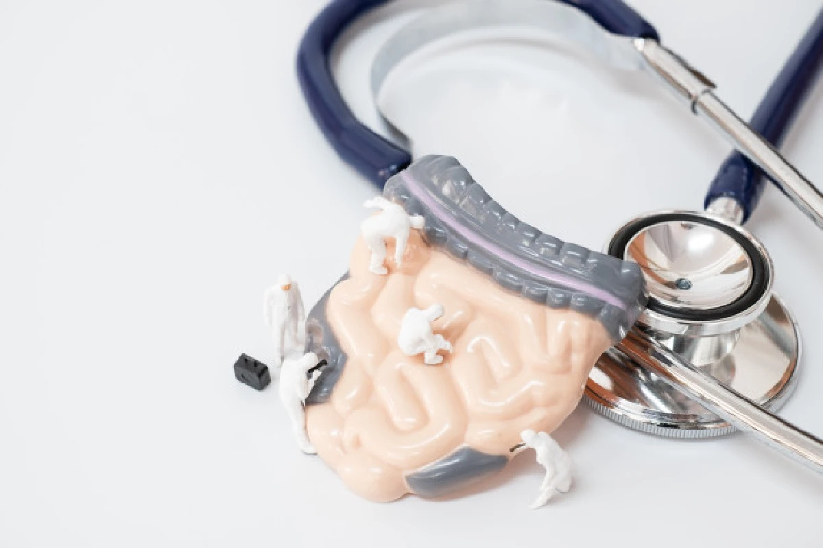 แพทย์ย้ำอาหารและพฤติกรรม ตัวการเพิ่มความเสี่ยงมะเร็งลำไส้