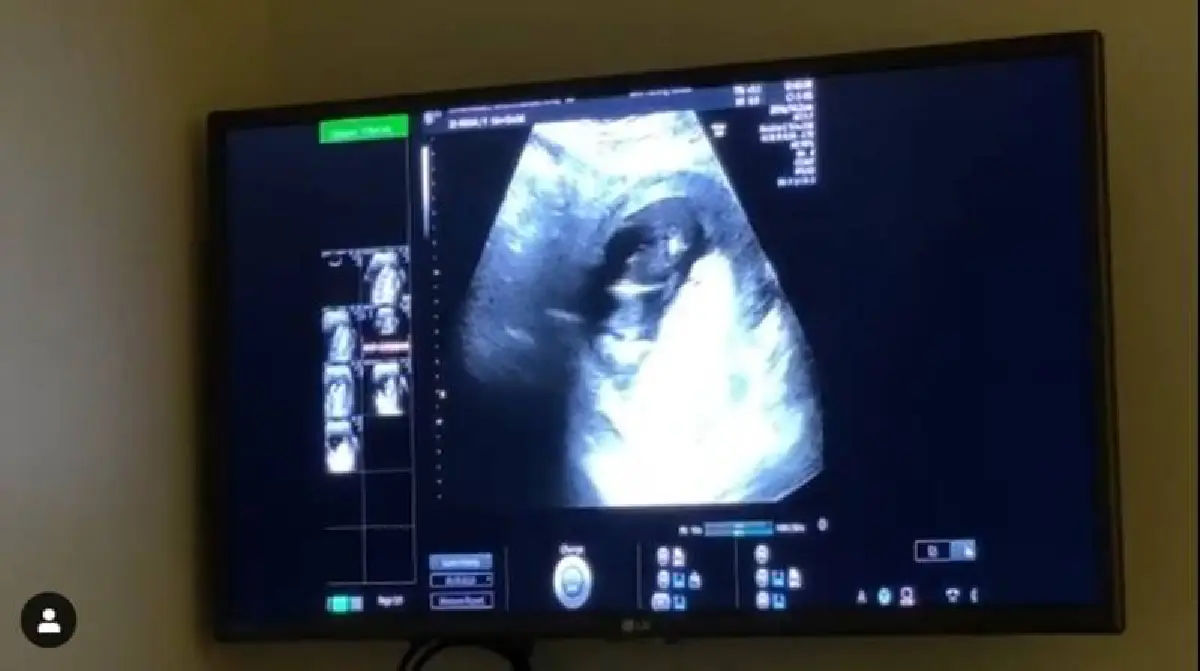 ศรีริต้า เจนเซ่น เผยคลิปอัลตราซาวด์ลูกคนแรก แซวขายาวเหมือนใครหนอ?