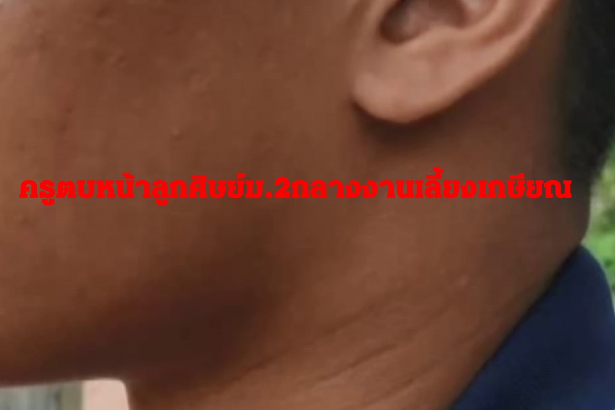 ฉาวอีก!ครูวัยทองเครียดขับรถชนหมาตายตบหน้าเด็กชายม.2กลางงานเลี้ยงเกษียณ ฉาวอีก!ครูวัยทองเครียดขับรถชนหมาตายตบหน้าเด็กชายม.2กลางงานเลี้ยงเกษียณ