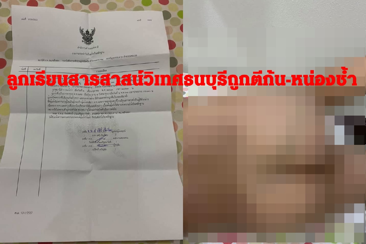 แม่เครียดลูกเรียนสารสาสน์วิเทศธนบุรีถูกตีก้น-หน่องช้ำ แม่เครียดลูกเรียนสารสาสน์วิเทศธนบุรีถูกตีก้น-หน่องช้ำ
