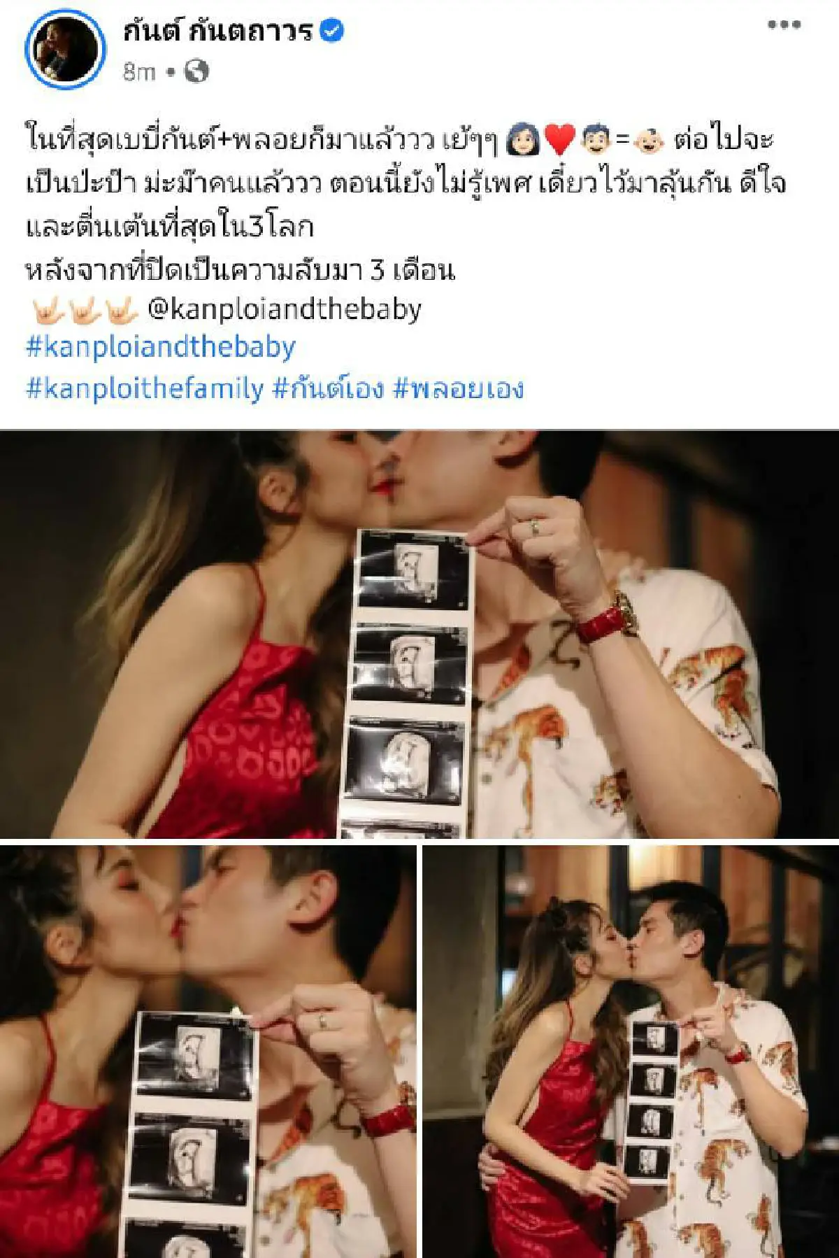 วันนี้ที่รอคอย "กันต์" สุดแฮปปี้ภรรยา "พลอย" ท้องแล้ว!