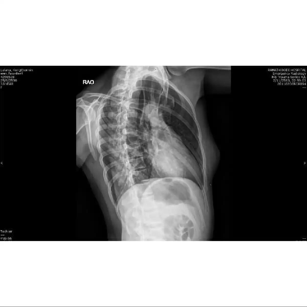 “หมอเจี๊ยบ ลลนา" ออกมาแจงละเอียดยิบ หลังเจอดราม่าใช้ยาชาก่อนขึ้นชก 