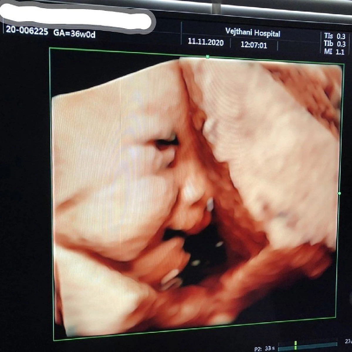 เตรียมโดนฟัด! ต๊ะ บอยสเก๊าท์ โชว์ภาพอัลตราซาวด์..หลงลูกสาวมาก