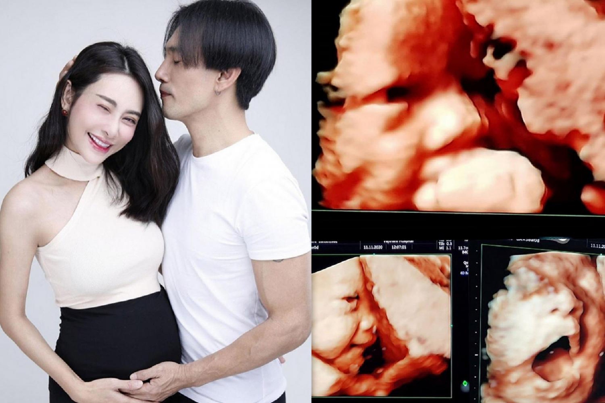 เตรียมโดนฟัด! ต๊ะ บอยสเก๊าท์ โชว์ภาพอัลตราซาวด์..หลงลูกสาวมาก เตรียมโดนฟัด! ต๊ะ บอยสเก๊าท์ โชว์ภาพอัลตราซาวด์..หลงลูกสาวมาก