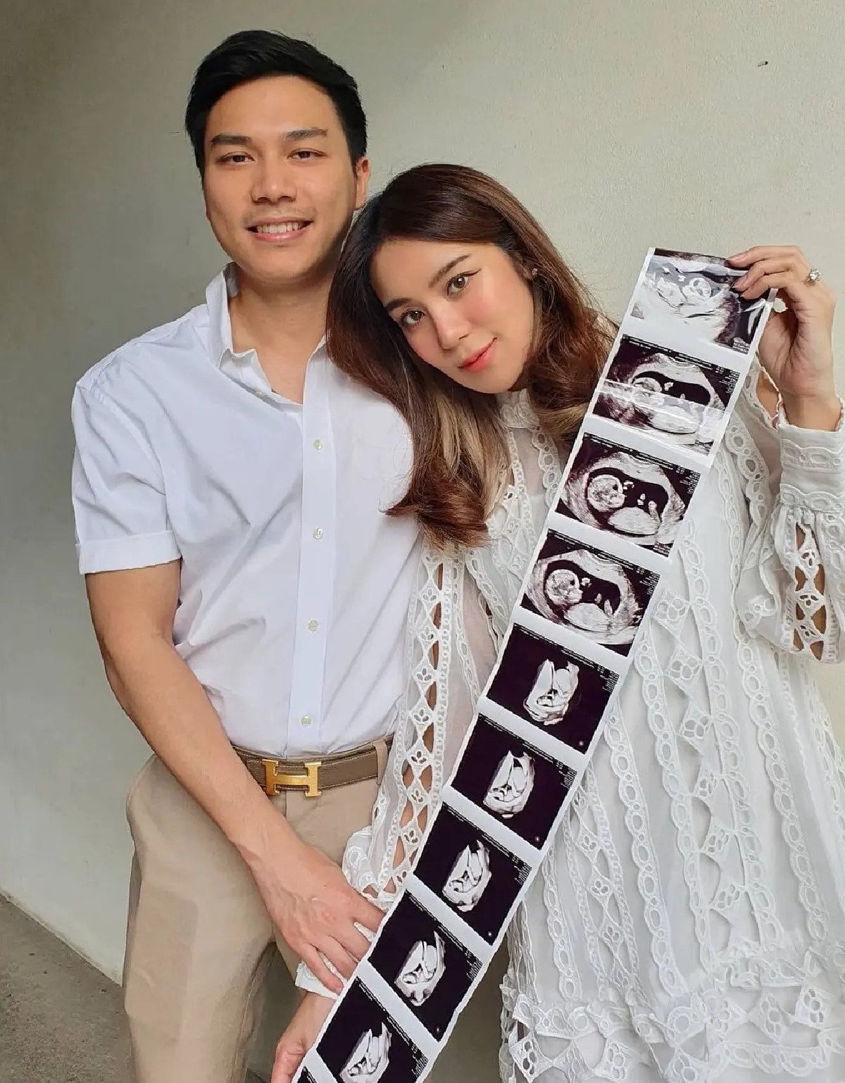 “ขนมจีน กุลมาศ” ประกาศข่าวดี! ตั้งท้องลูกคนแรกแล้ว พร้อมเผยภาพอัลตราซาวด์ให้ได้ชม